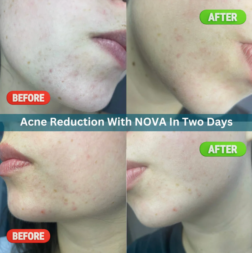 NOVA Face Jelly Serum Bar